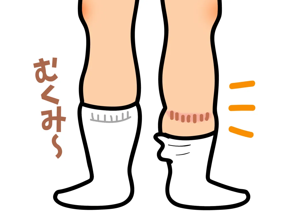 22701049 | 神楽坂のパーソナルジム|QUALITAS神楽坂店 浮腫んでいる足