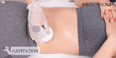 video_01cavitation | 神楽坂のパーソナルジム|QUALITAS神楽坂店 QUALITAS神楽坂店似てエステサービスを受けている女性01